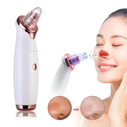 Blackhead Removal Suction Tool - Outsmart