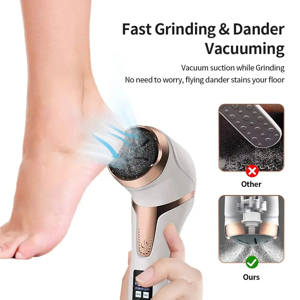 Electric Foot Callus Remover - Outsmart