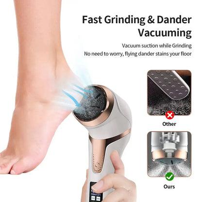 Electric Foot Callus Remover - Outsmart