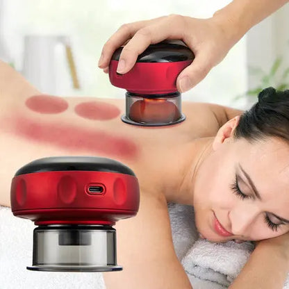 Electric Vacuum Cupping - Outsmart